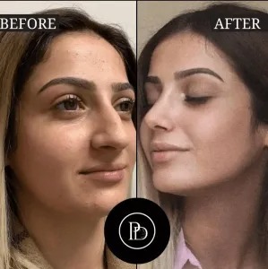 Natural Anti-Aging Solution: PRP Treatments in Dubai