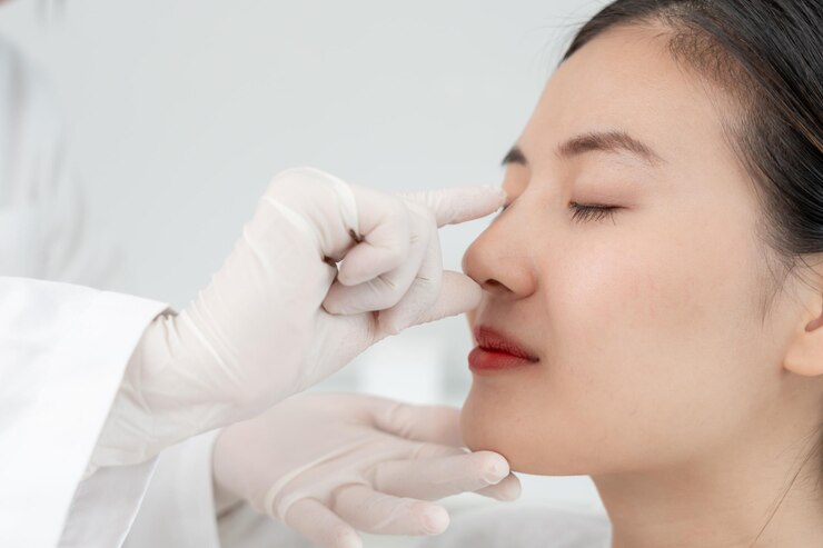 What Are the Benefits of Rhinoplasty