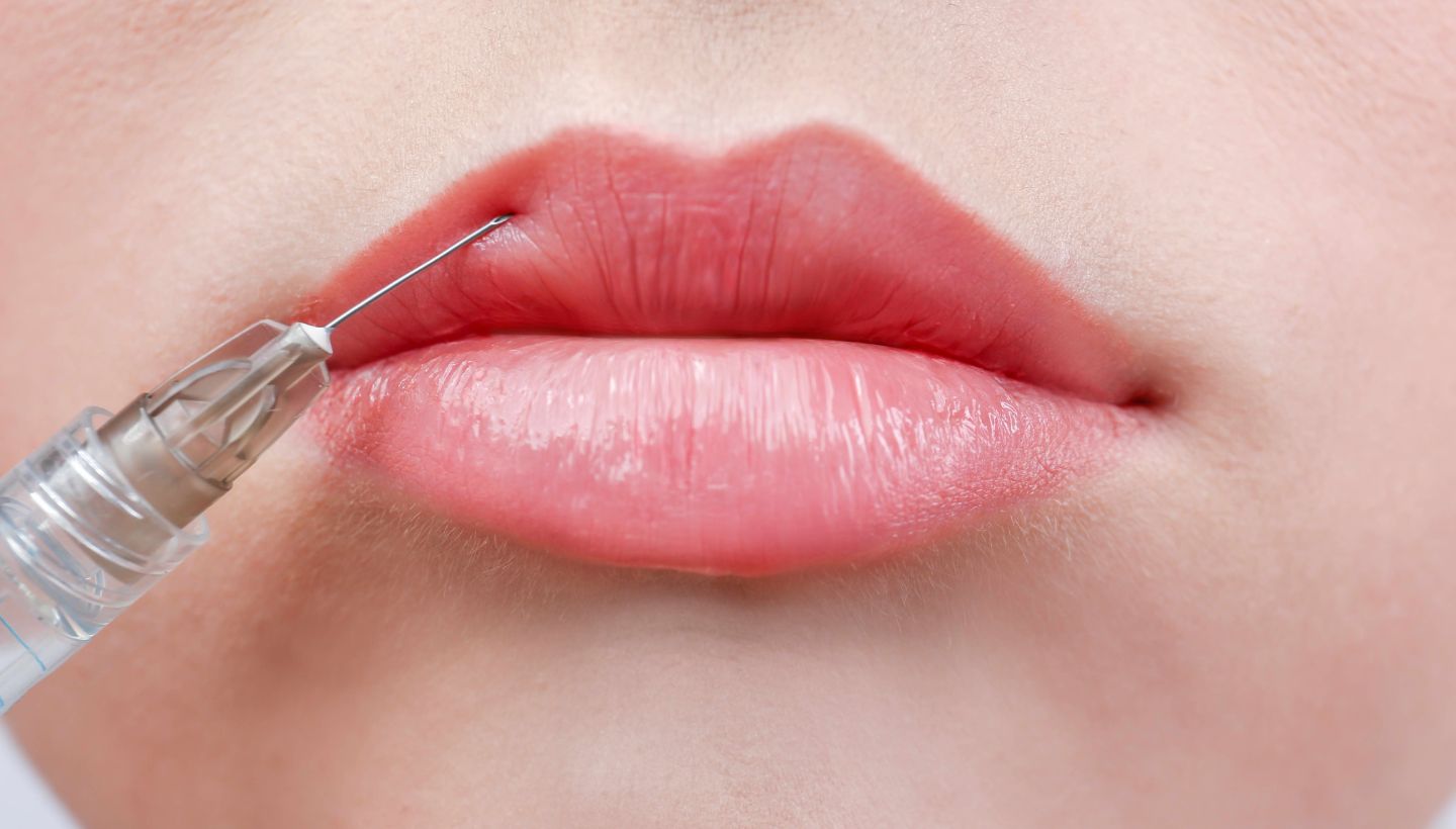 Do Russian Lip Fillers Help with Lip Symmetry?