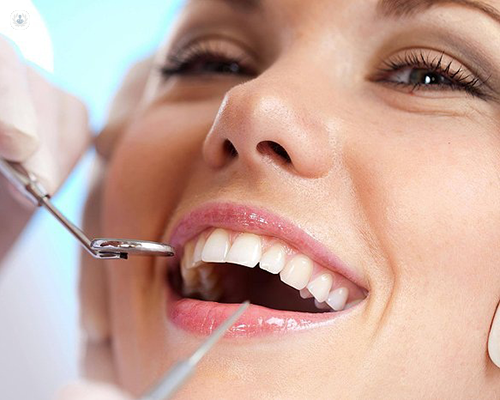 Understanding Fixed Dentures in Tampa: A Comprehensive Guide